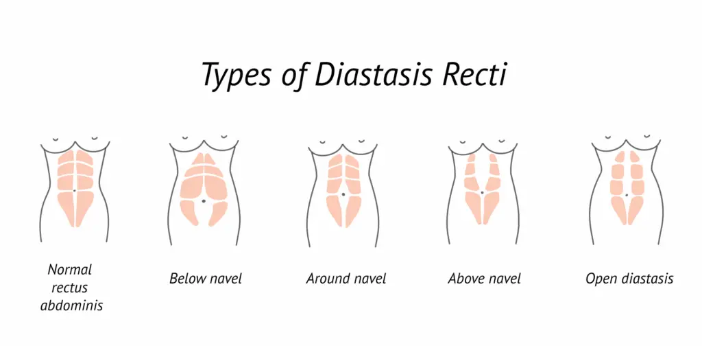 Types diastase